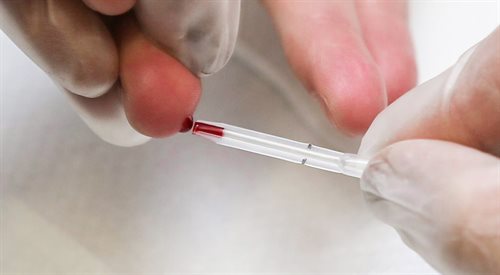 Trwa Europejski Tydzień Testowania na HIV