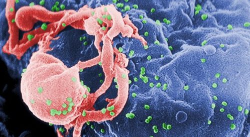 Wirus HIV-1 (kolor zielony) atakujący limfocyt
