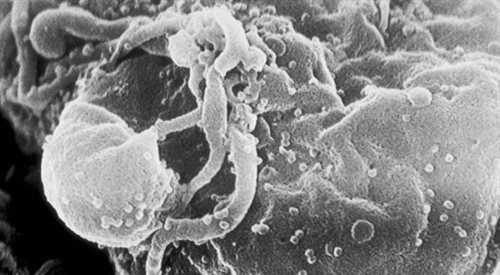 Wirus HIV pączkujący z limfocytu