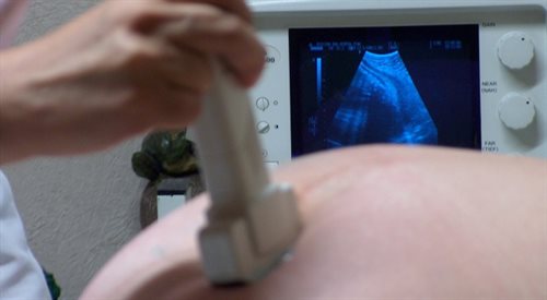 Badania prenatalne pomagają ratować życie dzieciom