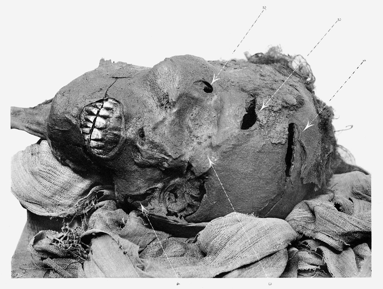 Głowa Sekenenre z zaznaczonymi miejscami ran odkrytymi podczas pierwszych badań mumii. Fot.: Wikimedia Commons/dp