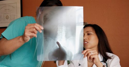 Osteoporoza. Dlaczego cichy złodziej kości atakuje? 