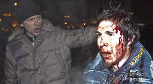 Ranny podczas starć z milicją uczestnik powyborczej manifestacji na Placu Niepodległości, 19 grudnia 2010 roku w Mińsku. Protestujący zebrali się wcześniej na Placu Październikowym, by zaprotestować przeciwko przebiegowi wyborów prezydenckich