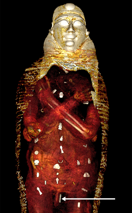 Układ amuletów w mumii "Złotego chłopca". Fot.: SN Saleem, SA Seddik, M el-Halwagy/CC BY