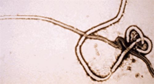 Mikroskopowy obraz wirusa Ebola
