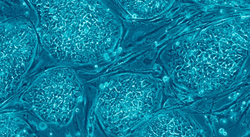 Ludzkie komórki macierzyste